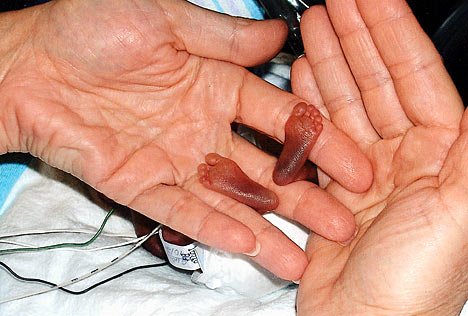 Avortul - cea mai puternică armă a morții în Europa