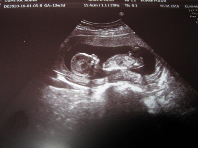 Avortul și anticoncepționalele - crime împotriva lui Dumnezeu