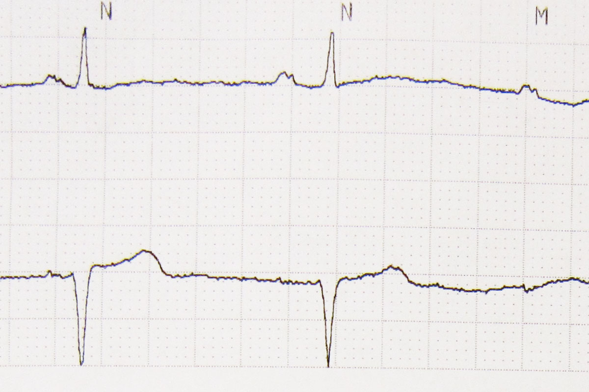 Electrocardiograme, în cabinetele medicilor de familie suceveni