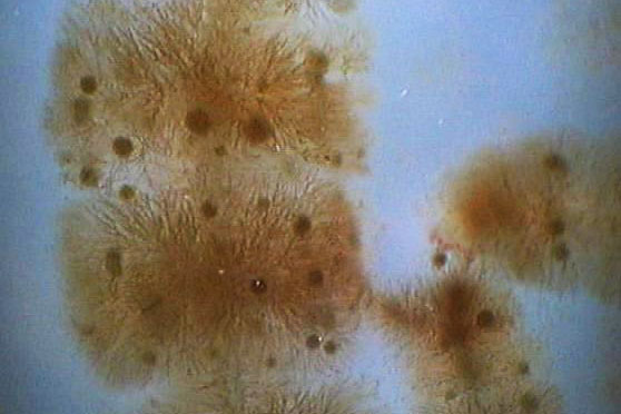 Algele, o posibilă soluţie pentru prevenirea cariilor