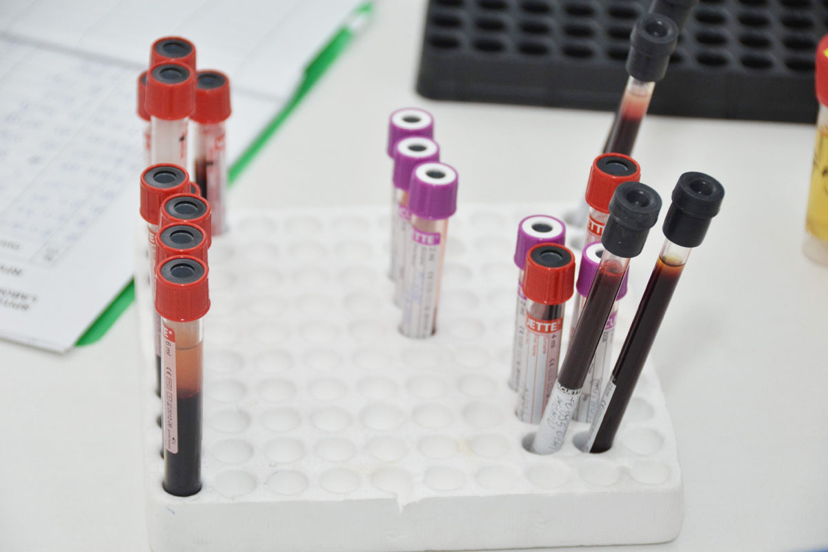 O boală subdiagnosticată