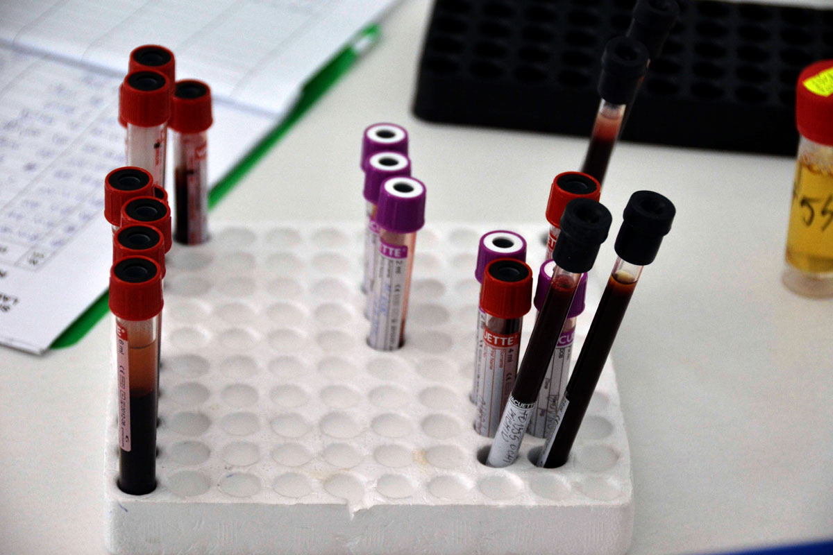 Peste un milion şi jumătate de români suferă de diabet