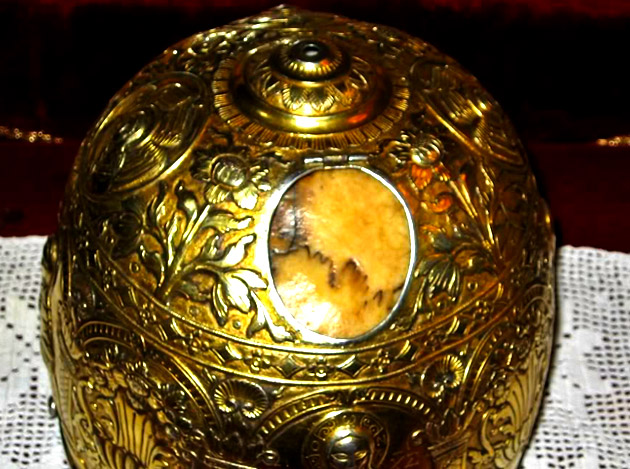 Vindecarea cancerului laringian