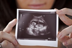 Libertatea avortului: „Cum poţi să iubeşti doi copii şi pe al treilea să-l omori?” Libertatea avortului: „Cum poţi să iubeşti doi copii şi pe al treilea să-l omori?”
