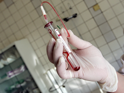 Doar 4,1% din cazurile de hepatită C beneficiază de tratament în România