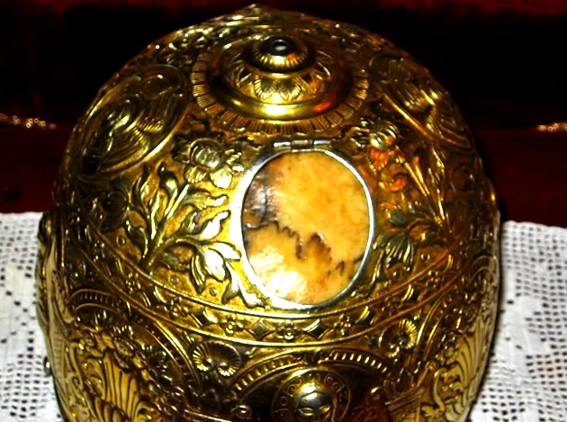 Copilul cu arsuri pe tot corpul