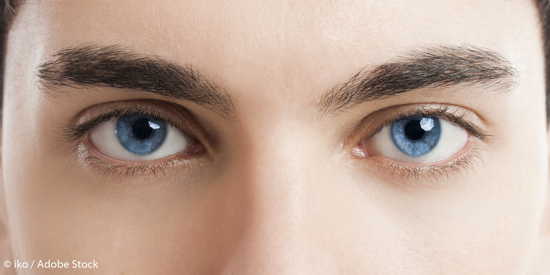 Cauze şi tratament în conjunctivitele alergice Cauze şi tratament în conjunctivitele alergice