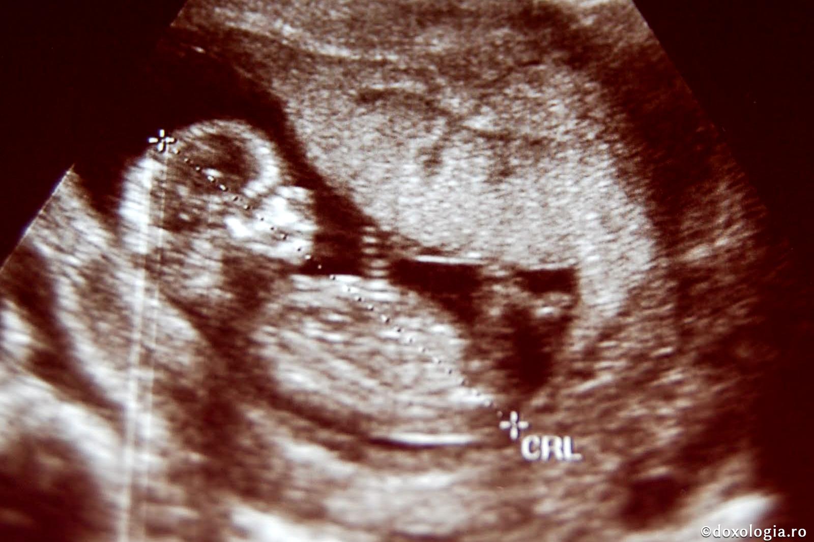 Foto: Anda Pintilie Avortul - un păcat înfricoşător