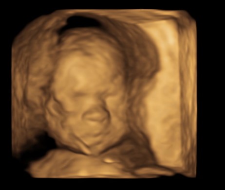 Morfologie fetală la cel mai mic preţ din Iaşi, la Policlinica Providenţa