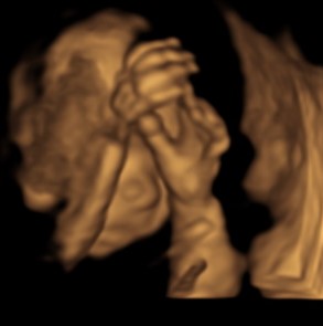 Morfologie fetală la cel mai mic preţ din Iaşi, la Policlinica Providenţa