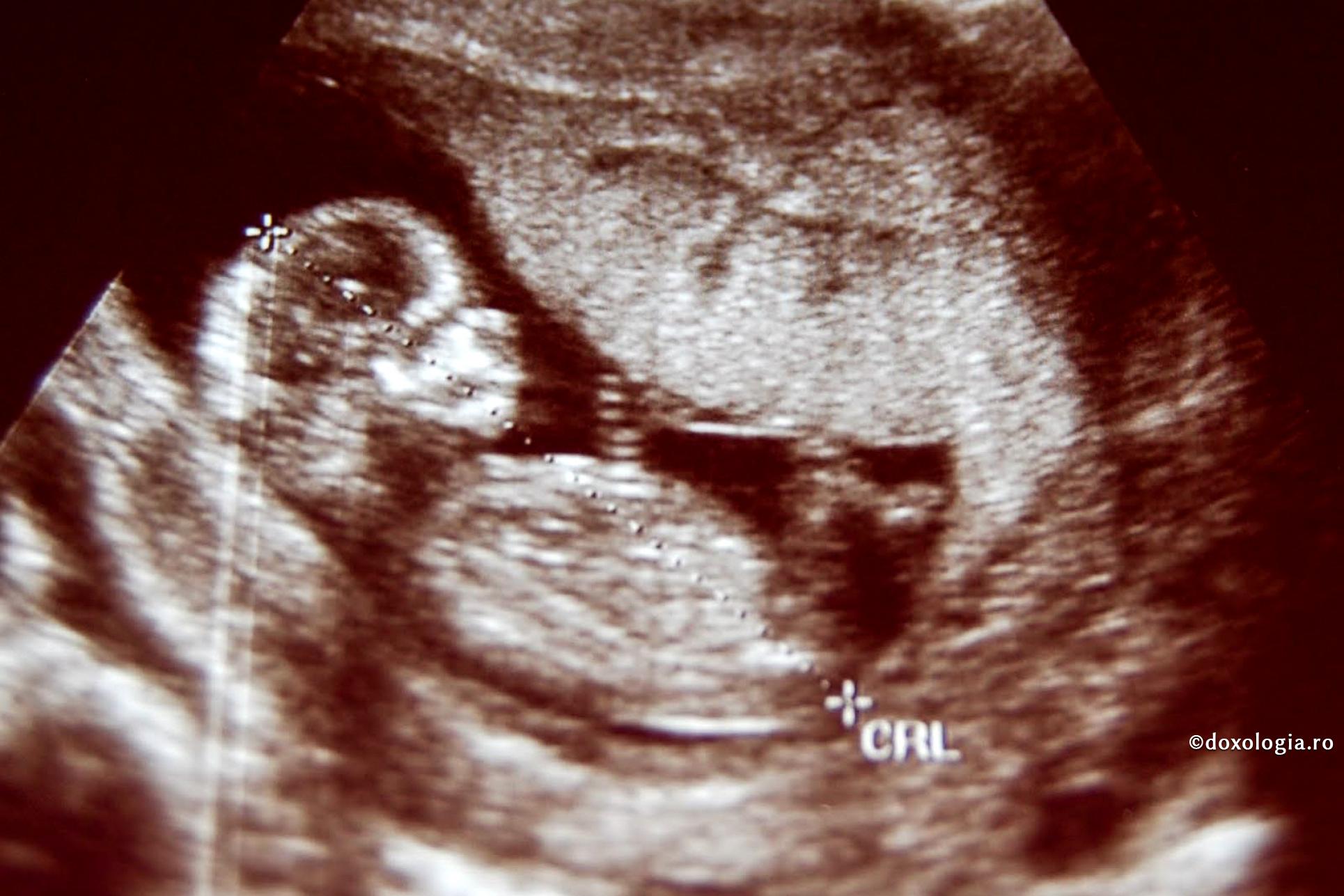 De sărbătoarea Brâncovenilor, la București va fi inaugurat un nou centru de sprijin pentru femei în criză de sarcină