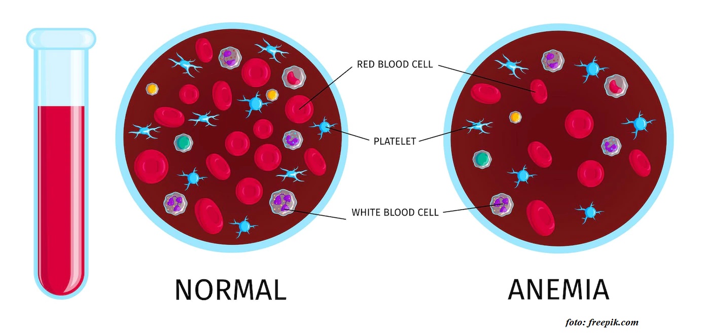 Anemia – interviu cu Dr. Ionela Adriana Vlăduțu