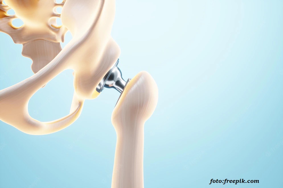 Artroplastia de șold – intervenția care schimbă viața: interviu cu dr. Mădălina Elena Gorie, medic specialist recuperare Artroplastia de șold – intervenția care schimbă viața: interviu cu dr. Mădălina Elena Gorie, medic specialist recuperare