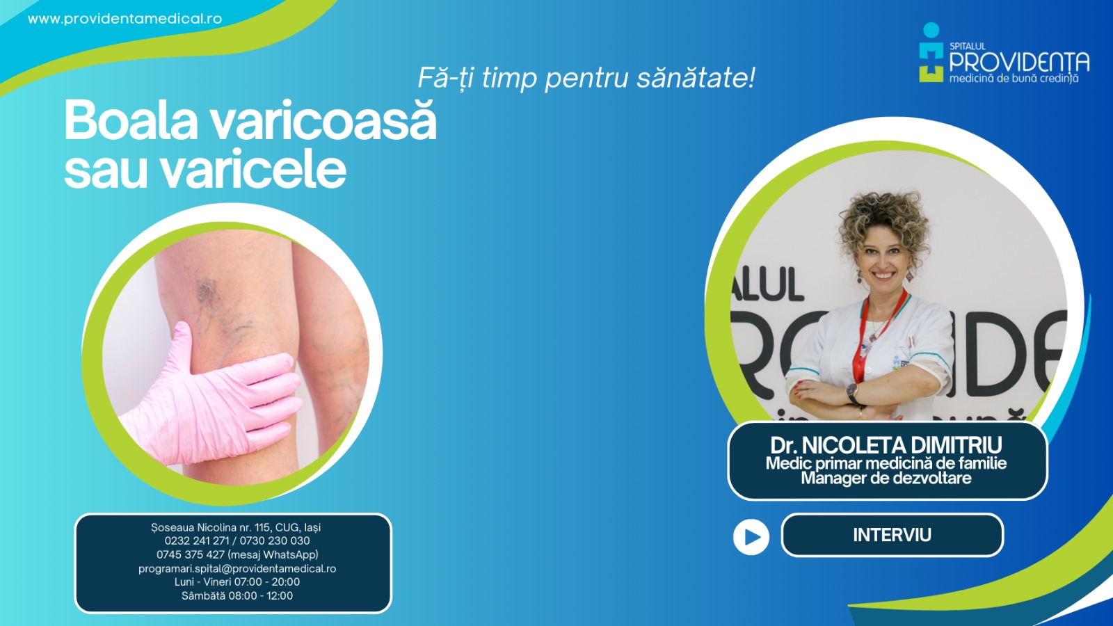 Tot ce trebuie să știi despre boala varicoasă/ varice