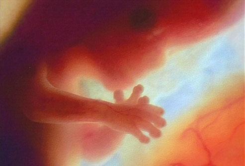 Aberaţia salvării vieţii prin avort