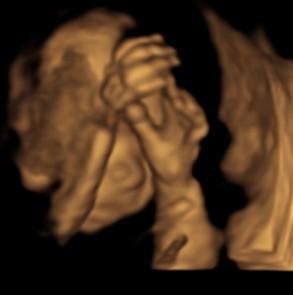 Morfologie fetală la cel mai mic preţ din Iaşi, la Policlinica Providenţa