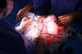 Pacient: Occidentul. Diagnostic: cancer cu metastaze