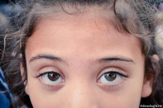 ochi
