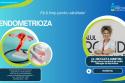 Endometrioza – o boală greu de depistat